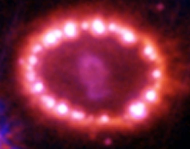 SN1987A's Cosmic Perlas