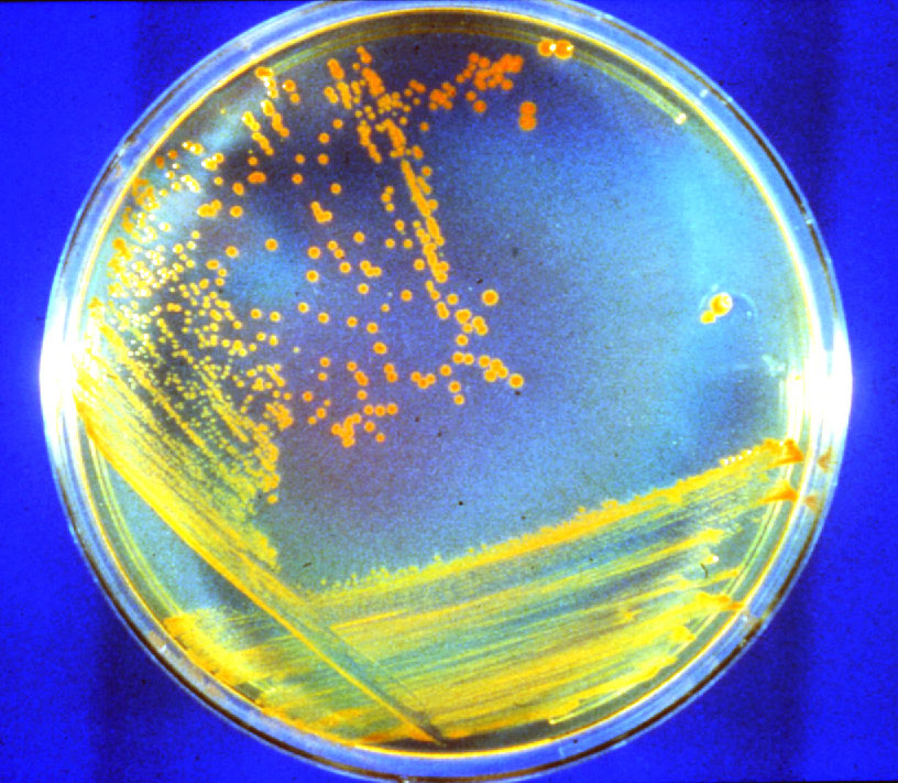 Bacterias D. rad : candidatas a astronauta