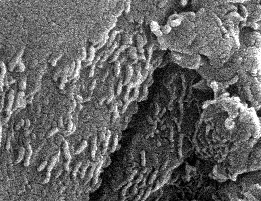 ¿Primitiva Vida Microscópica en Marte?